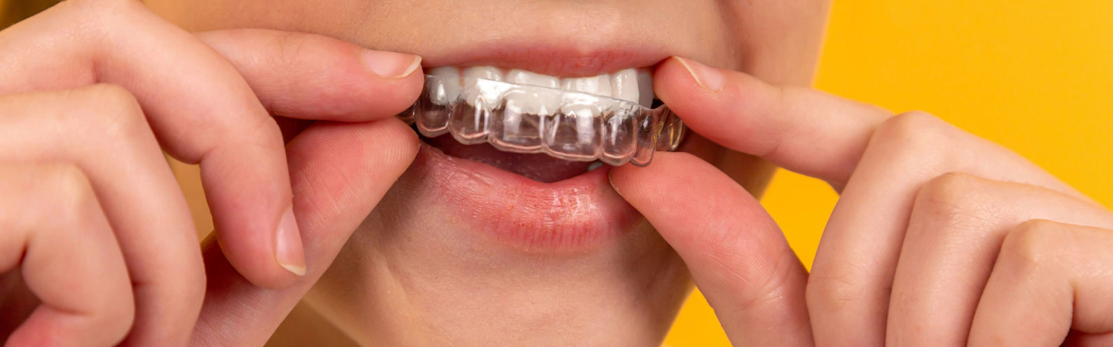 Better Protection for Online Orthodontics Patients